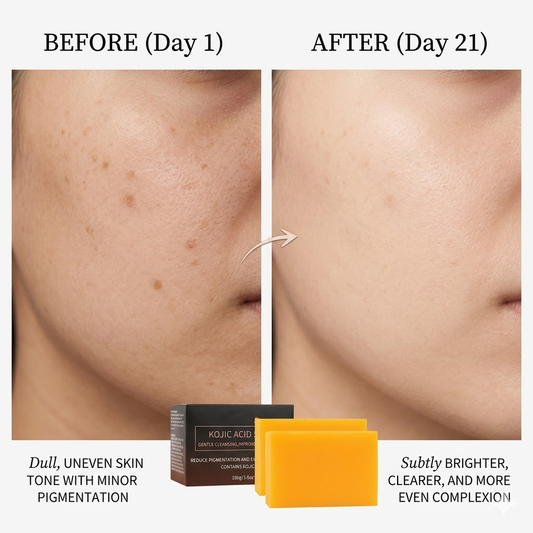 Virotenacosh Professional Kojic Acid Skin Brightening Soap - Intensive Dark Spot Corrector & Hyperpigmentation Treatment - Even Skin Tone Facial Cleanser